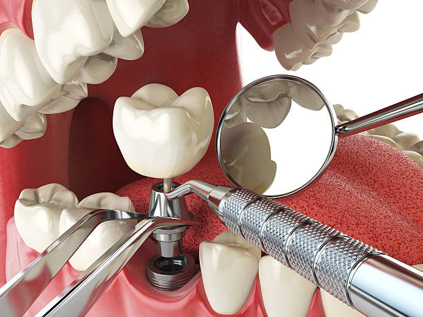 Best Emergency Dental Services for Seniors in Gantt, SC